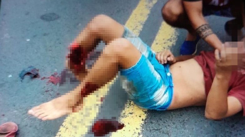 Tres jóvenes heridos, uno de ellos grave tras choque entre motos