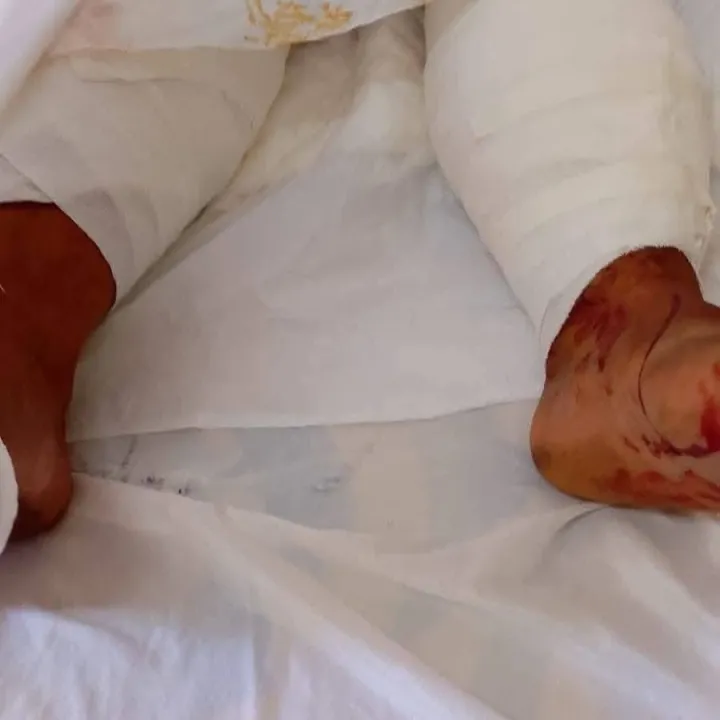 Monte Caseros: una vecina fue atacada por cuatro perros y est&aacute; internada en estado delicado