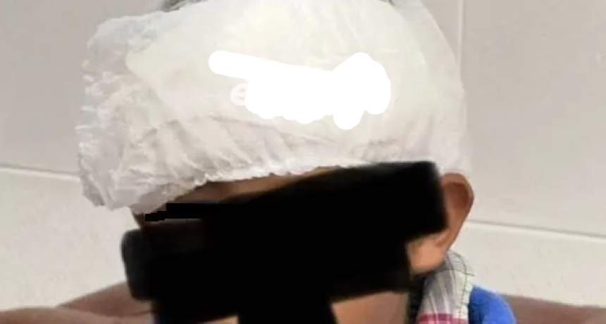 Mercedes: brutal agresi&oacute;n a un ni&ntilde;o de 10 a&ntilde;os termin&oacute; con 50 puntos de sutura