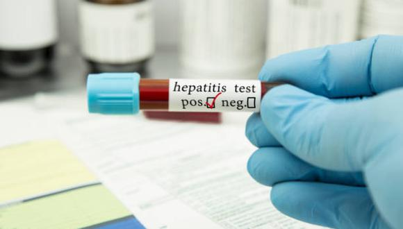 Un estudio vincula la hepatitis grave detectada en niños con el coronavirus
