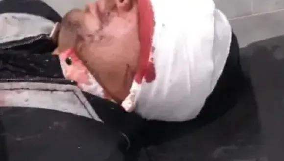 Sangriento enfrentamiento en San Miguel: Dos cu&ntilde;ados terminaron desfigurados tras atacarse a machetazos