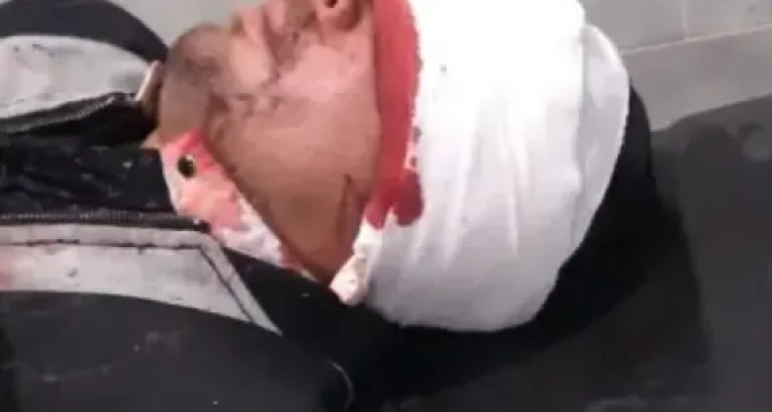 Sangriento enfrentamiento en San Miguel: Dos cu&ntilde;ados terminaron desfigurados tras atacarse a machetazos